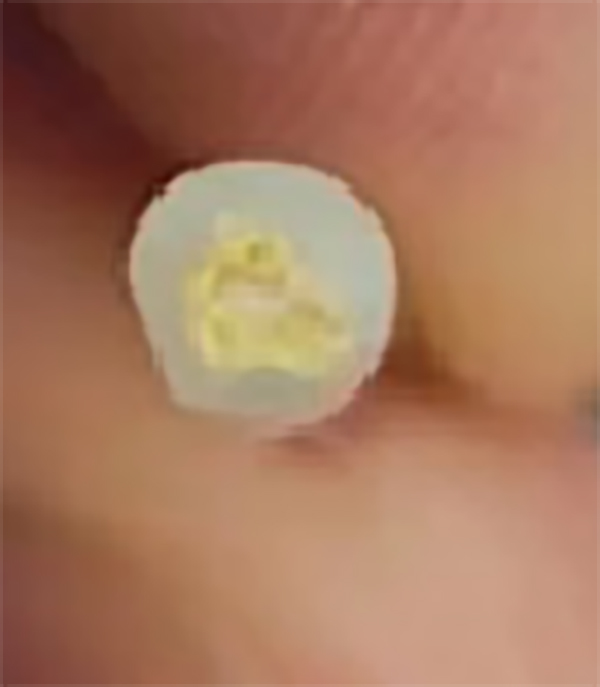 非金屬鎧裝光纖纜繩橫截面 非金屬鎧裝光纖纜繩橫截面